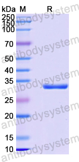 Recombinant Human RIOK3 Protein, N-His