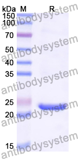 Recombinant Human CDIPT Protein, N-His-KSI