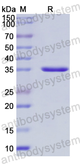 Recombinant Human GNB5 Protein, N-His