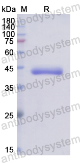 Recombinant Human APOL1 Protein, N-His