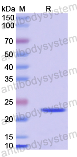 Recombinant Human SH2D1B Protein, N-His-SUMO