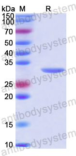 Recombinant Human GIPC1 Protein, N-His