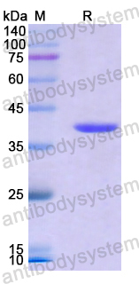 Recombinant Human IKBKB Protein, N-His
