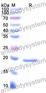 Recombinant Human UBE2L6 Protein, N-His