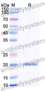Recombinant Human UQCRQ Protein, N-His-KSI