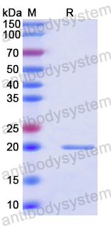 Recombinant Human HGS Protein, N-His