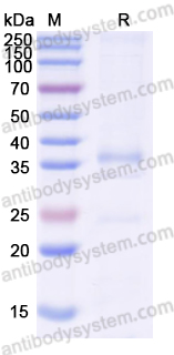 Recombinant Human AURKA Protein, N-His