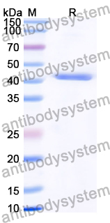 Recombinant Human SLC27A2 Protein, N-His