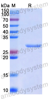 Recombinant Human ATP2A1 Protein, N-His