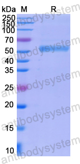 Recombinant Human KDM6B Protein, N-His