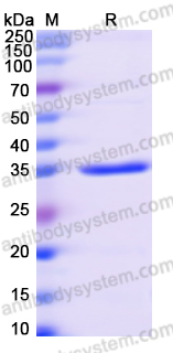 Recombinant Human PER2 Protein, N-His