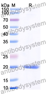 Recombinant Human ZBTB5 Protein, N-His