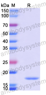 Recombinant Human CEP290 Protein, N-His