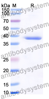 Recombinant Human DEGS1 Protein, N-GST & C-His