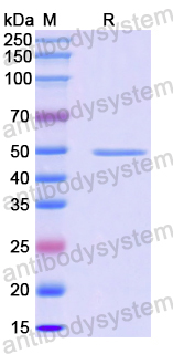 Recombinant Human KPNA5 Protein, N-His