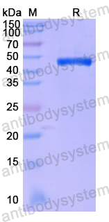 Recombinant Human ARPC1B Protein, N-His
