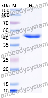 Recombinant Human POLR1C Protein, N-His