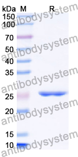 Recombinant Human EPHB6 Protein, N-His