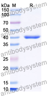 Recombinant Human ADAMDEC1 Protein, N-His