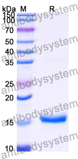 Recombinant Human ZBTB22 Protein, N-His