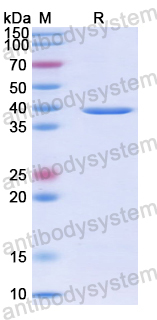 Recombinant Human WDR46 Protein, N-His