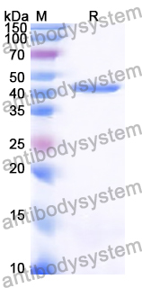 Recombinant Human MATN3/Matrilin-3 Protein, N-His