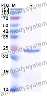 Recombinant Human VGF Protein, N-His