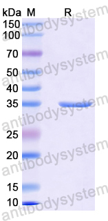 Recombinant Human ATXN7 Protein, N-GST & C-His