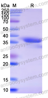 Recombinant Human SPTLC2 Protein, N-His