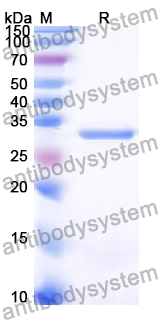 Recombinant Human FANCG Protein, N-His