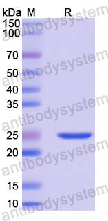 Recombinant Human ALOX15B Protein, N-His-SUMO
