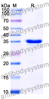 Recombinant Human PPM1D Protein, N-His