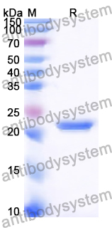 Recombinant Human PPM1G Protein, N-His