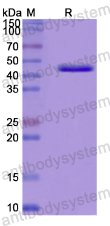 Recombinant Human EIF3D Protein, N-His