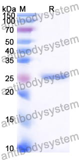 Recombinant Human YY2 Protein, N-His