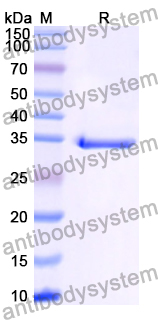 Recombinant Human SLC16A3/MCT4 Protein, N-GST & C-His