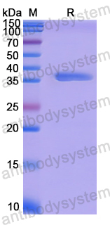 Recombinant Human CLOCK Protein, N-His