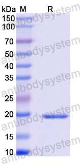 Recombinant Human SOCS1 Protein, N-His