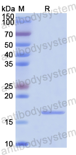 Recombinant Human RGS5 Protein, N-His
