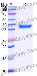 Recombinant Human CYB5B Protein, N-GST & C-His