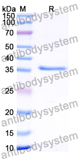 Recombinant Human PRPF4 Protein, N-His