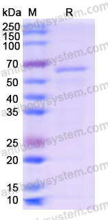 Recombinant Human PHGDH Protein, N-His