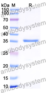 Recombinant Human CRX Protein, N-GST & C-His