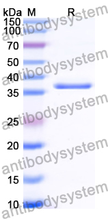 Recombinant Human ZNHIT1 Protein, N-GST & C-His
