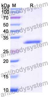 Recombinant Human B4GALT5 Protein, N-His