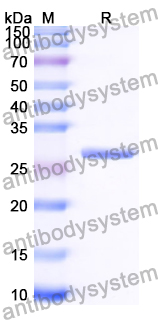 Recombinant Human SART1 Protein, N-His