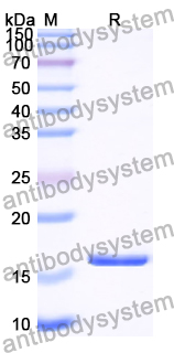 Recombinant Human ZBTB43 Protein, N-His