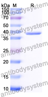 Recombinant Human ZSCAN12 Protein, N-His