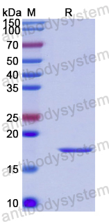 Recombinant Human TPD52L2 Protein, N-His