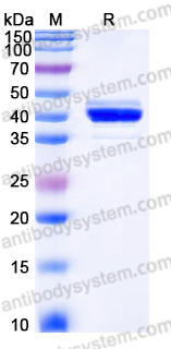 Recombinant Human FIBP Protein, Tag free